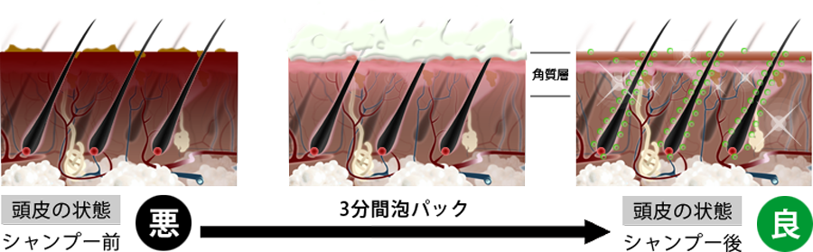 頭皮の状態が悪い→3分間泡パック→頭皮の状態がよくなる