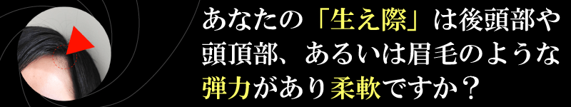 あなたの「生え際」は後頭部や頭頂部、あるいは眉毛のような弾力があり柔軟ですか？