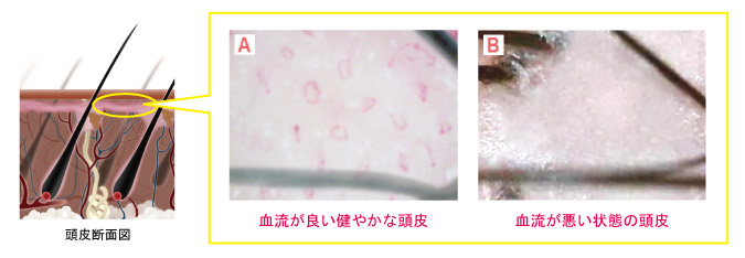 健やかな頭皮