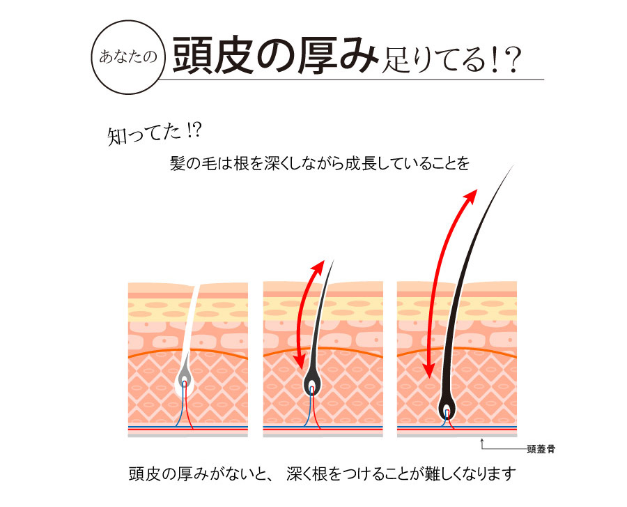 頭皮の厚み