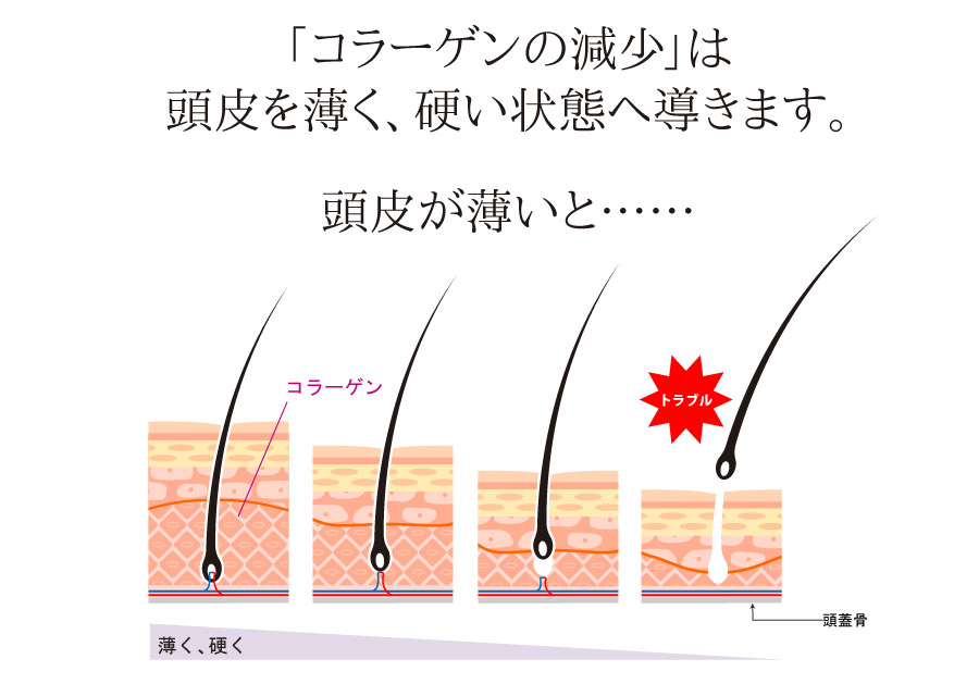 頭皮が薄く硬く