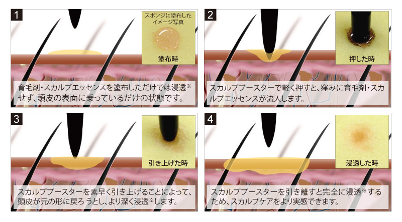 モンゴ流スカルプブースターの凸部分が頭皮に窪みを作り、育毛剤・エッセンスの浸透を後押しします。