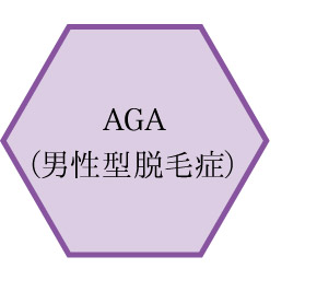 AGA男性型脱毛症