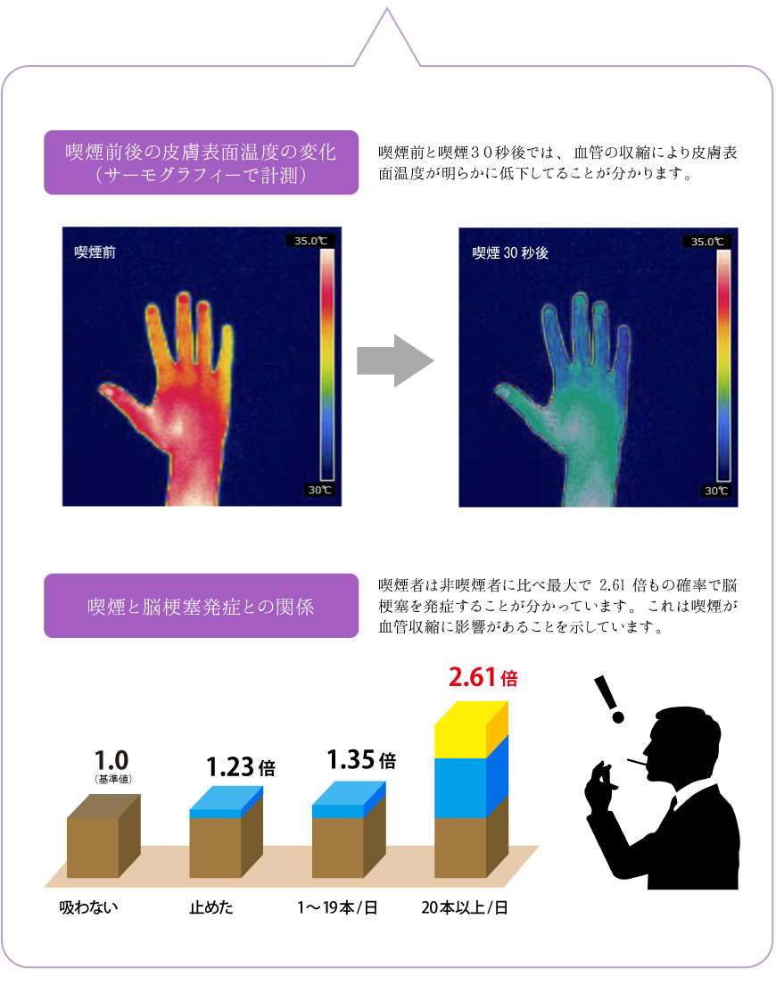 喫煙と血行不良の因果関係