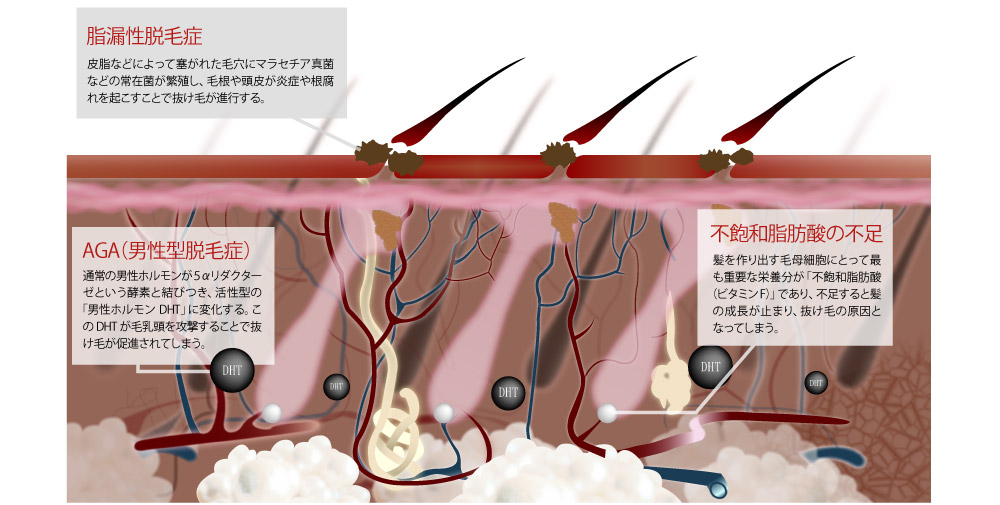 髪と頭皮のイラスト