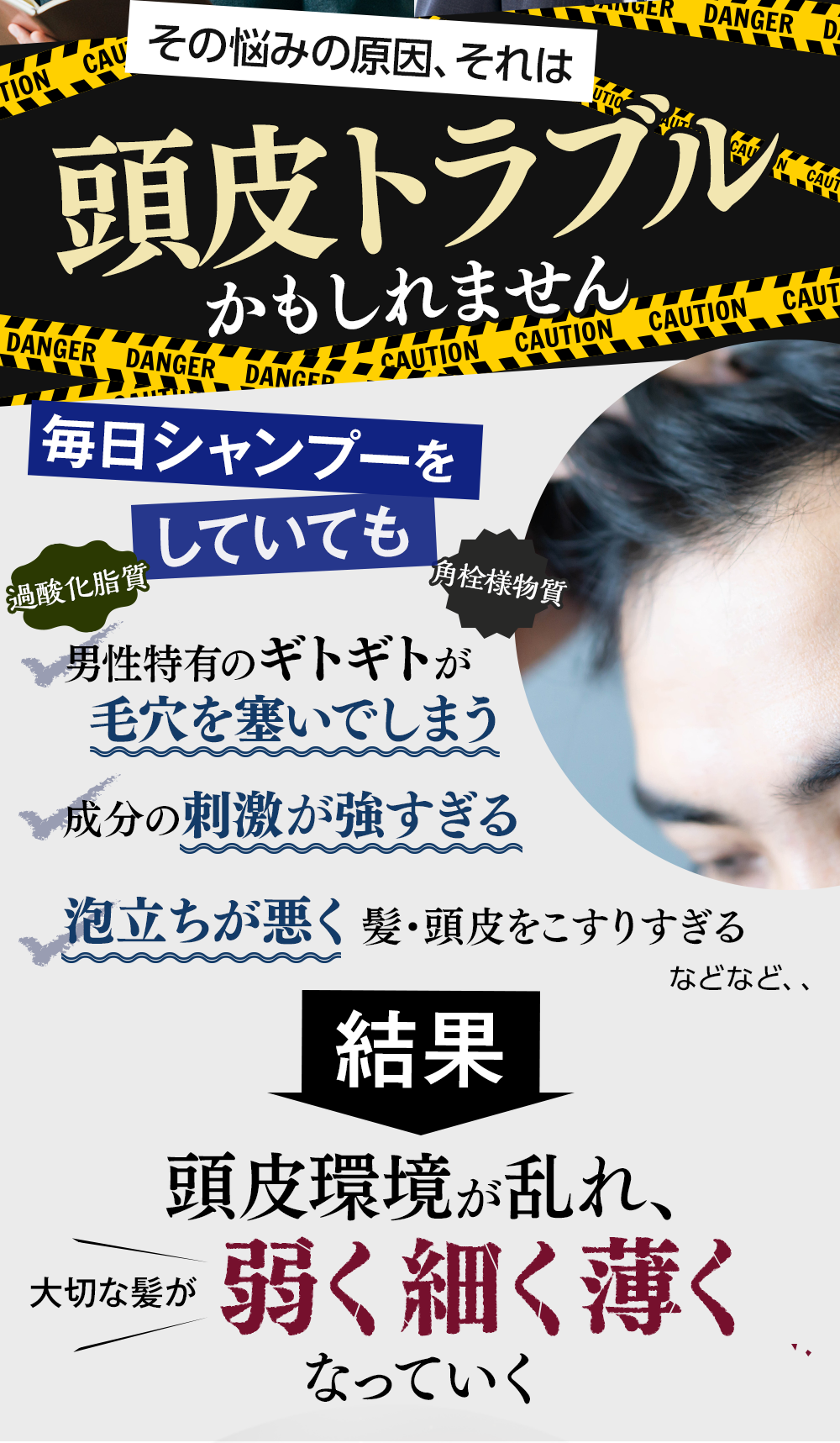 頭皮トラブルかもしれません